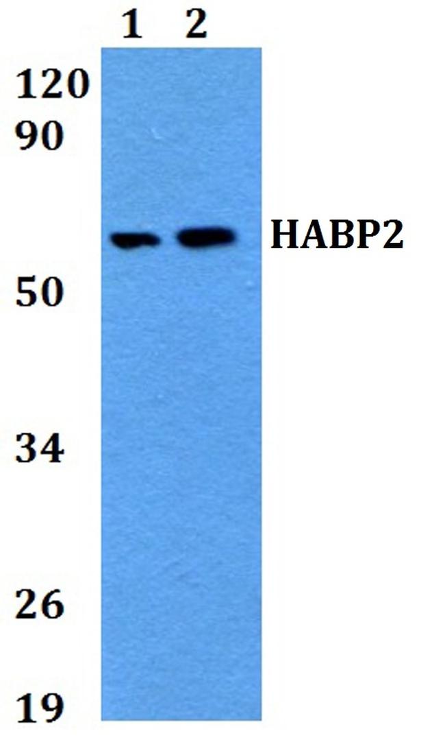 HABP2 Antibody in Western Blot (WB)