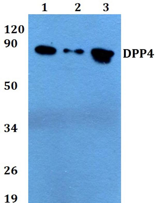 CD26 Antibody in Western Blot (WB)