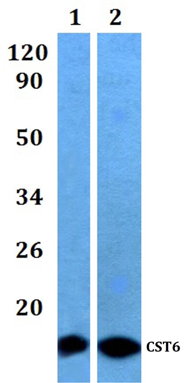 Cystatin M Antibody in Western Blot (WB)