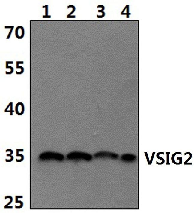 VSIG2 Antibody in Western Blot (WB)