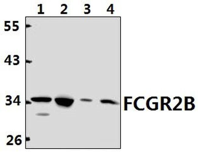 CD32b Antibody in Western Blot (WB)