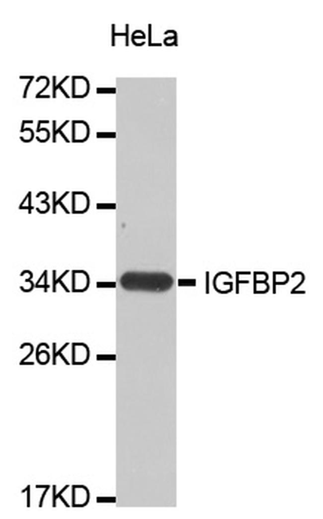 IGFBP2 Antibody in Western Blot (WB)