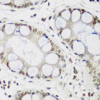 HP1 gamma Antibody in Immunohistochemistry (Paraffin) (IHC (P))