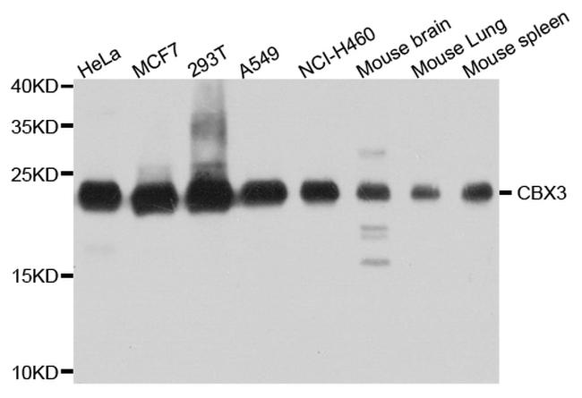 HP1 gamma Antibody in Western Blot (WB)