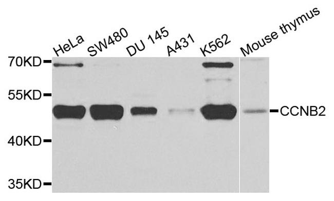 Cyclin B2 Antibody in Western Blot (WB)