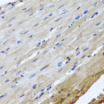 FANCI Antibody in Immunohistochemistry (Paraffin) (IHC (P))