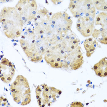 FANCI Antibody in Immunohistochemistry (Paraffin) (IHC (P))