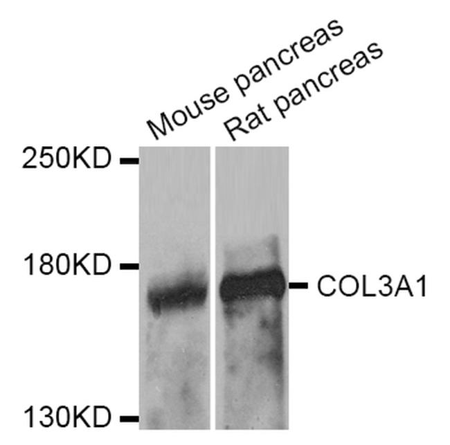 Collagen I/III Antibody in Western Blot (WB)