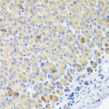 Glutaminase Antibody in Immunohistochemistry (Paraffin) (IHC (P))