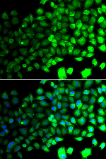 AMPK alpha-2 Antibody in Immunocytochemistry (ICC/IF)