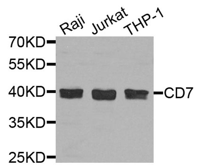 CD7 Antibody in Western Blot (WB)