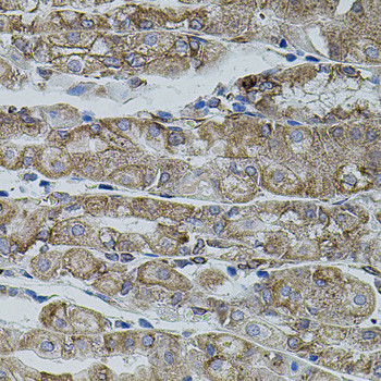 SHH Antibody in Immunohistochemistry (Paraffin) (IHC (P))