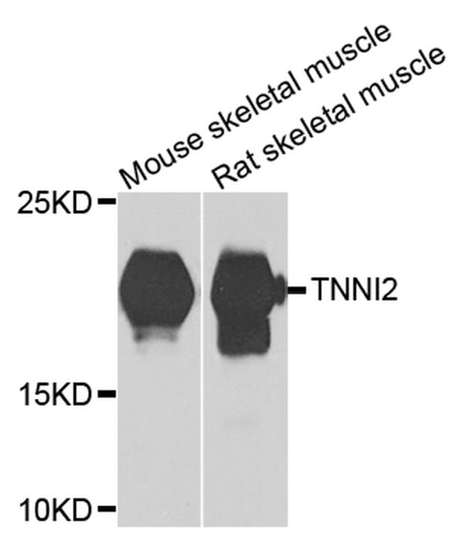 TNNI2 Antibody in Western Blot (WB)