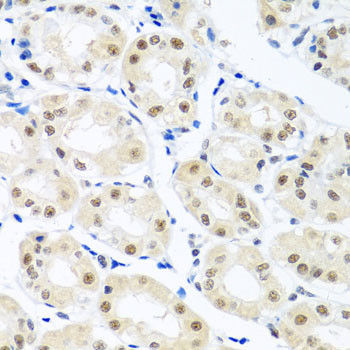 Nuclear Matrix Protein p84 Antibody in Immunohistochemistry (Paraffin) (IHC (P))