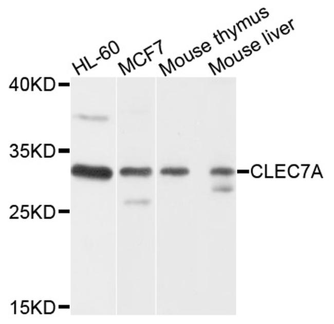 CD369 (Clec7a, Dectin-1) Antibody in Western Blot (WB)