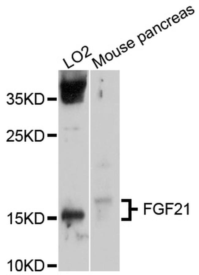 FGF21 Antibody in Western Blot (WB)