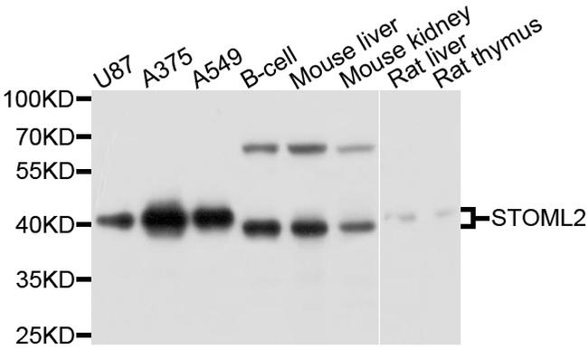 STOML2 Antibody in Western Blot (WB)