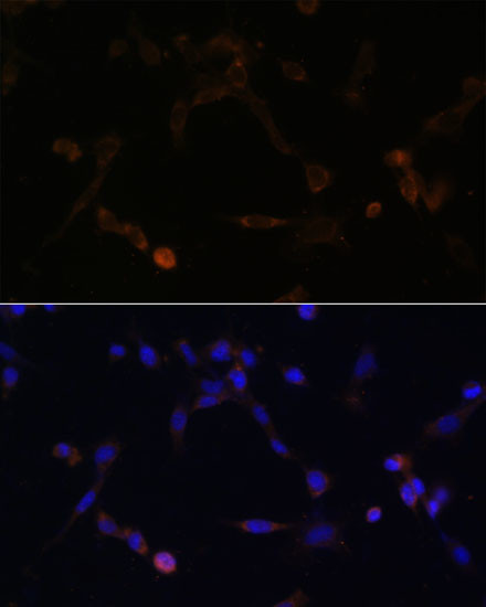 UBE2L6 Antibody in Immunocytochemistry (ICC/IF)