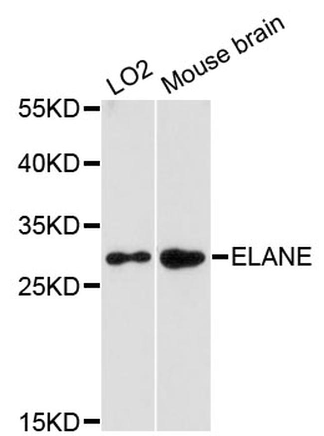 Neutrophil elastase Antibody in Western Blot (WB)