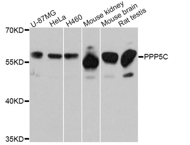 PP5 Antibody in Western Blot (WB)