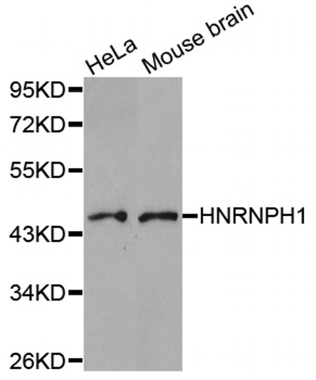 hnRNP H1 Antibody in Western Blot (WB)