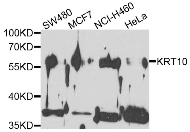 Cytokeratin 10 Antibody in Western Blot (WB)