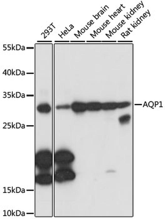 Aquaporin 1 Antibody in Western Blot (WB)