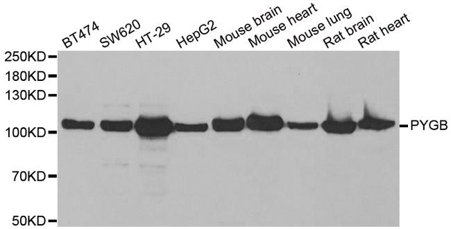 GPBB Antibody in Western Blot (WB)