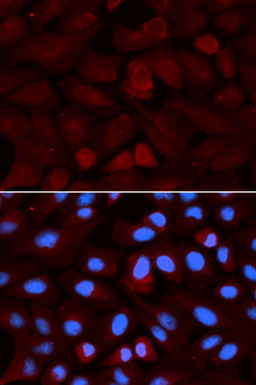 ALDH3A1 Polyclonal Antibody (PA5-87257)