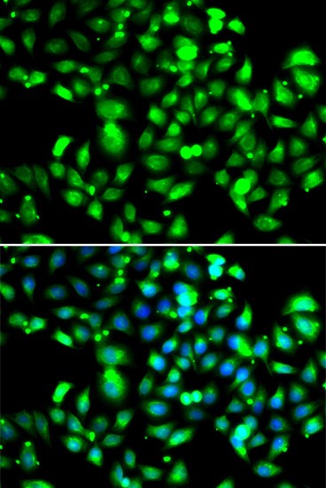 GBP1 Antibody in Immunocytochemistry (ICC/IF)