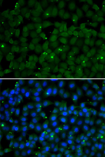 GPI Antibody in Immunocytochemistry (ICC/IF)