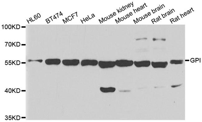 GPI Antibody in Western Blot (WB)