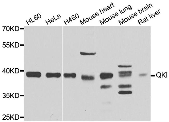 QKI Antibody in Western Blot (WB)