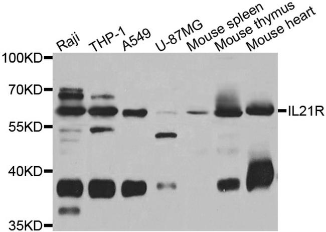 IL21R Antibody in Western Blot (WB)