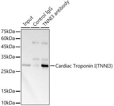 Cardiac Troponin I Antibody in Immunoprecipitation (IP)