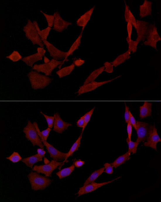 DOK4 Antibody in Immunocytochemistry (ICC/IF)