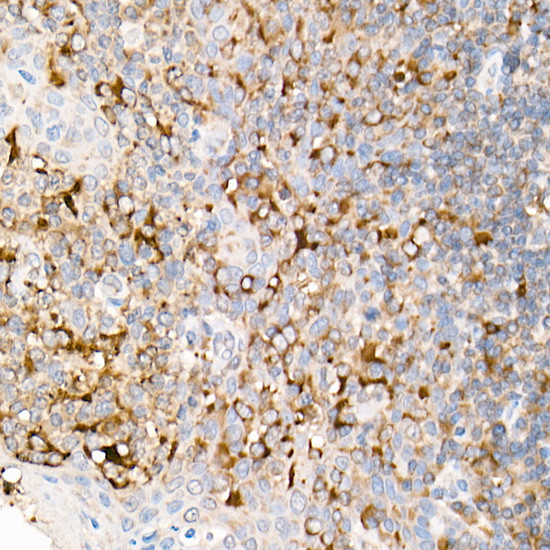 CD178 Antibody in Immunohistochemistry (Paraffin) (IHC (P))