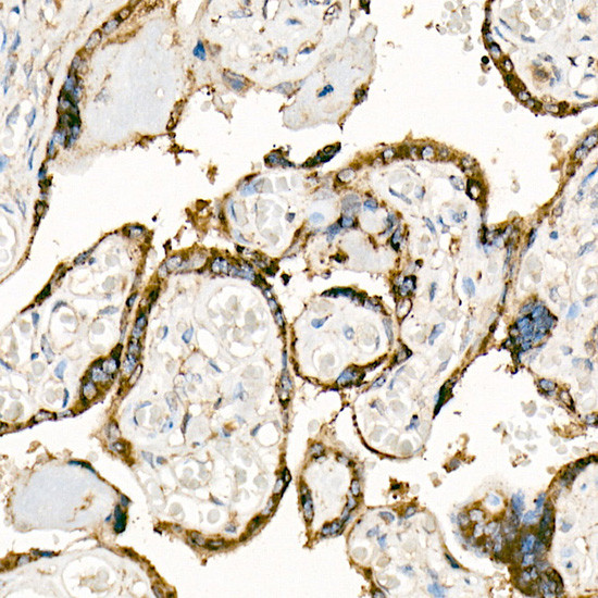 CD178 Antibody in Immunohistochemistry (Paraffin) (IHC (P))