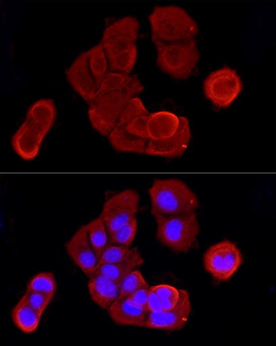 Cytokeratin 19 Antibody in Immunocytochemistry (ICC/IF)