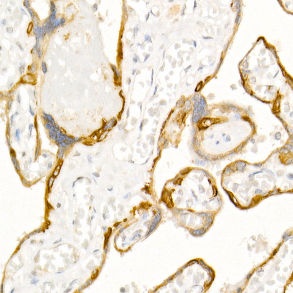 Cytokeratin 19 Antibody in Immunohistochemistry (Paraffin) (IHC (P))