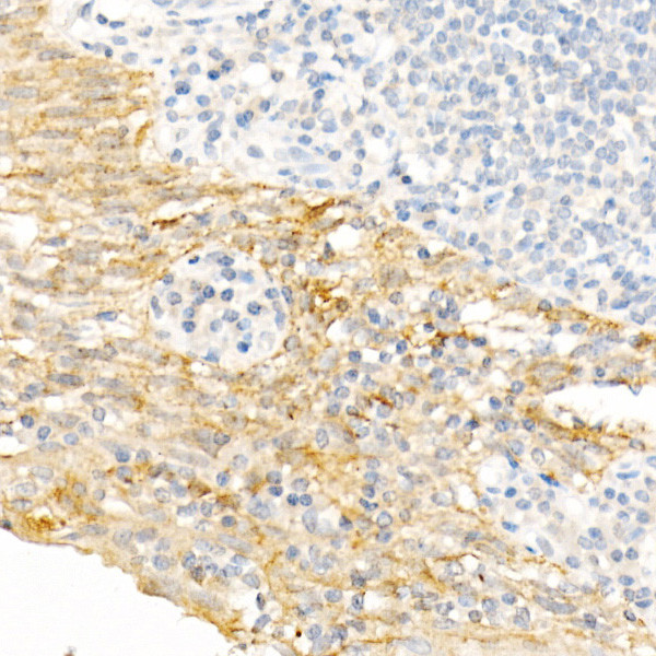 Cytokeratin 19 Antibody in Immunohistochemistry (Paraffin) (IHC (P))