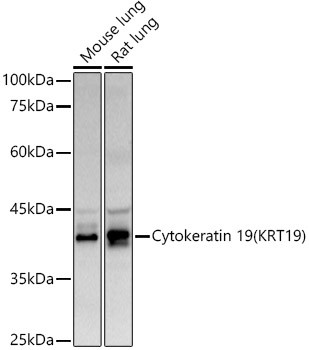 Cytokeratin 19 Antibody in Western Blot (WB)