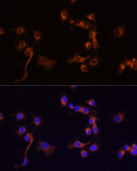 c-Abl Antibody in Immunocytochemistry (ICC/IF)