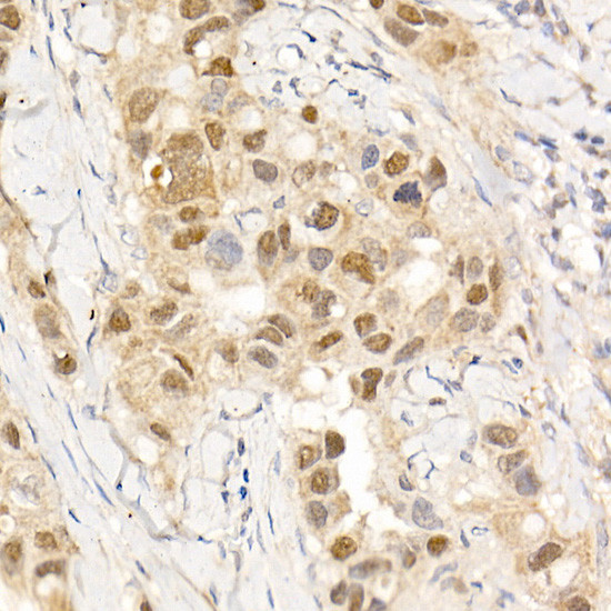 c-Abl Antibody in Immunohistochemistry (Paraffin) (IHC (P))