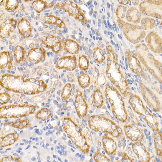 c-Abl Antibody in Immunohistochemistry (Paraffin) (IHC (P))