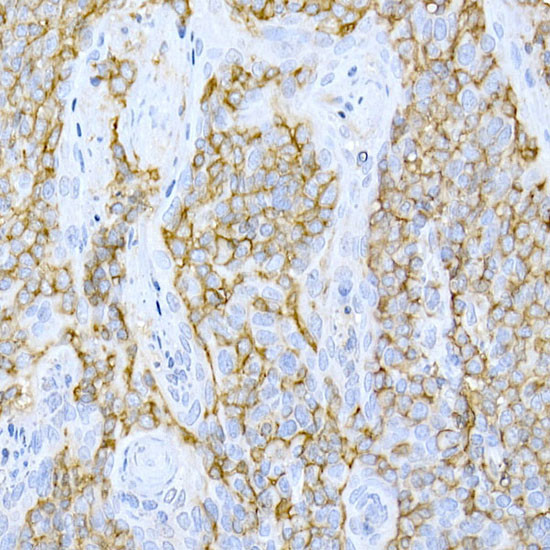 CD44 Antibody in Immunohistochemistry (Paraffin) (IHC (P))