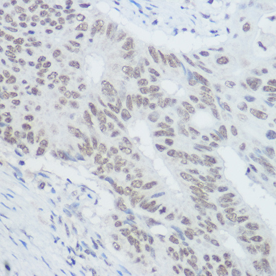 XRCC1 Antibody in Immunohistochemistry (Paraffin) (IHC (P))