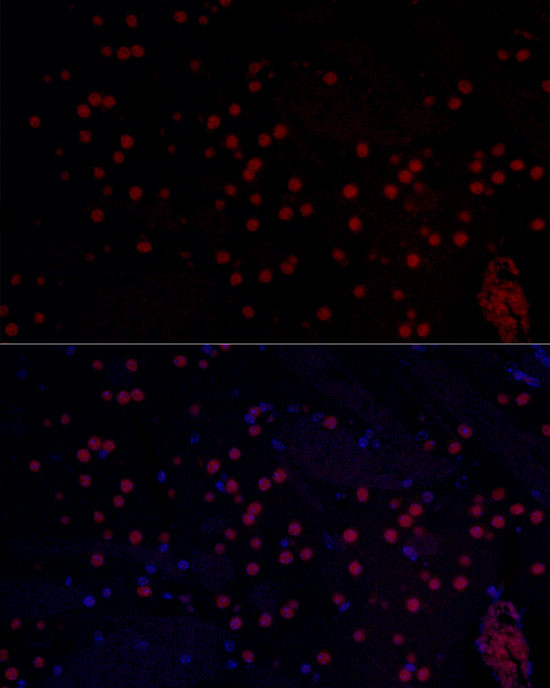 n-Myc Antibody in Immunohistochemistry (Paraffin) (IHC (P))