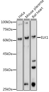 ELK1 Antibody in Western Blot (WB)