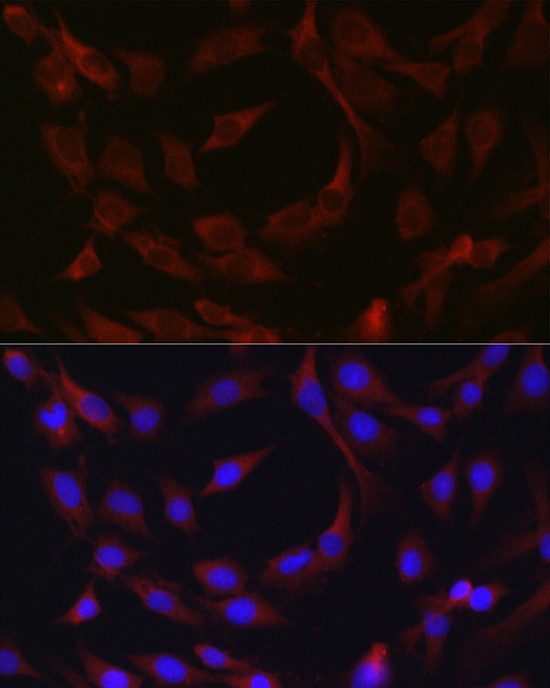 cIAP2 Antibody in Immunocytochemistry (ICC/IF)